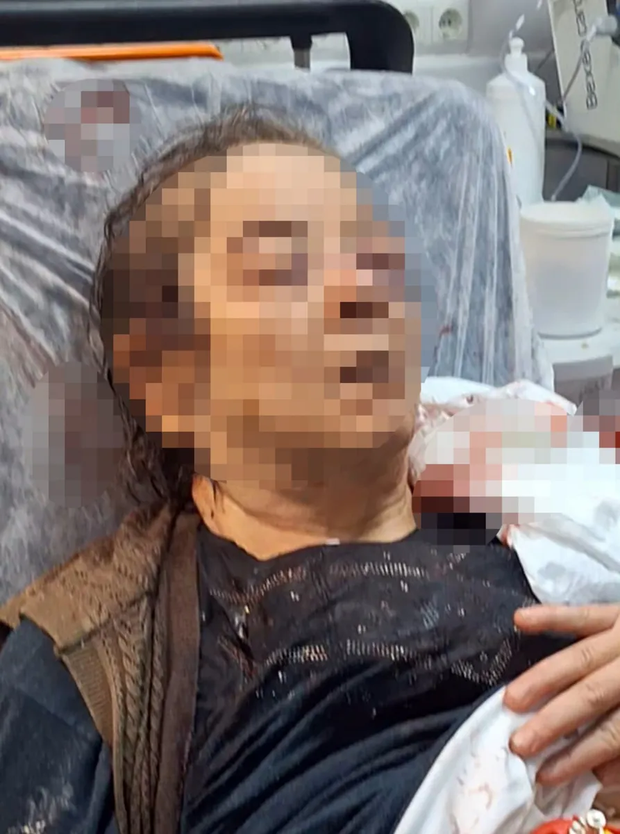 Kayseri Melikgazi'de evinin tavanı çöken 75 yaşındaki kadın yaralandı