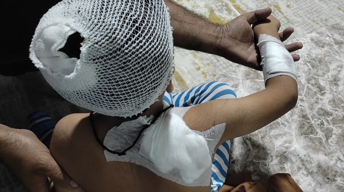Şanlıurfa Viranşehir'de sahipsiz köpeklerin saldırısına uğrayan çocuk yaralandı