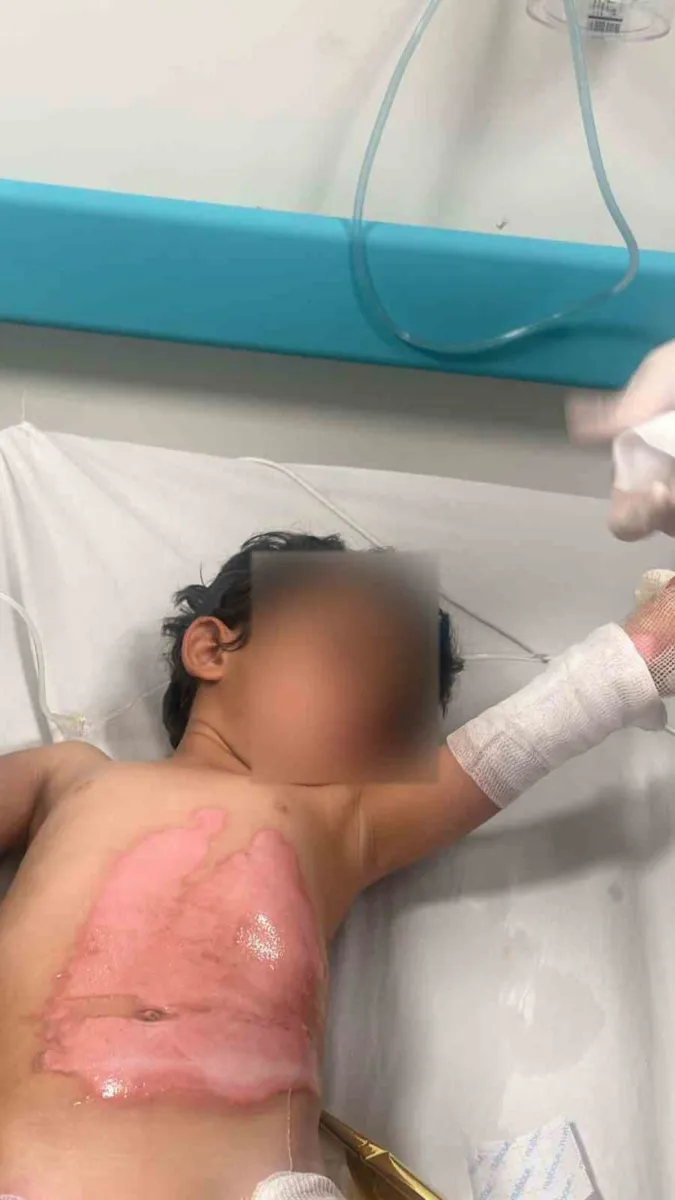 Şırnak Kumçatı'da kaynar su kazası: 3 yaşındaki çocuk yaralandı